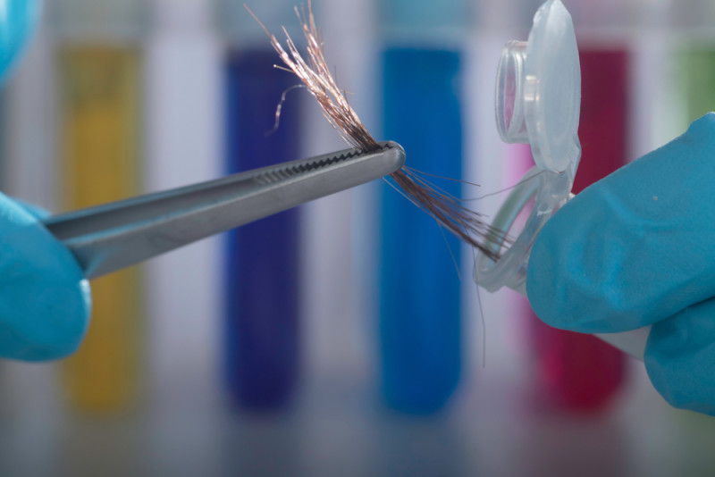 Analyse de cheveux - drogue  | Monamende.be
